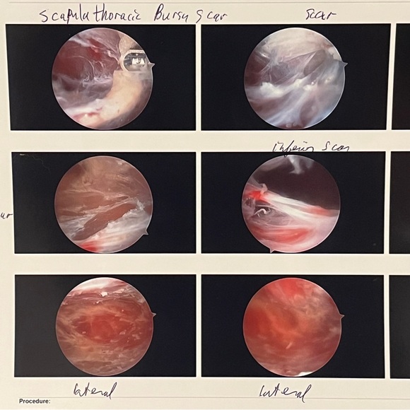 Waiting on next specialist🧿Malpractice Complications🧿 - Picture 9 of 11